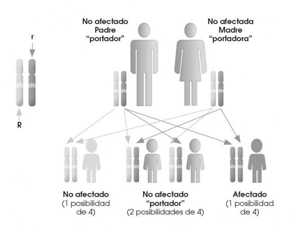 Enfermedad de Niemann-Pick - Wikipedia, la enciclopedia libre